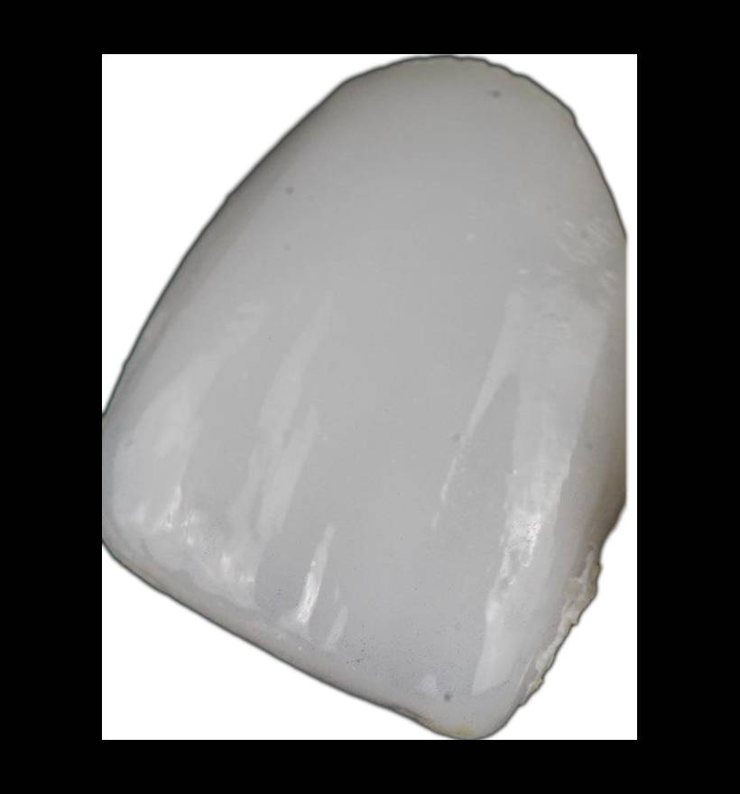 Faccetta del commercio: ceramica opaca, la luce si ferma sulla superficie