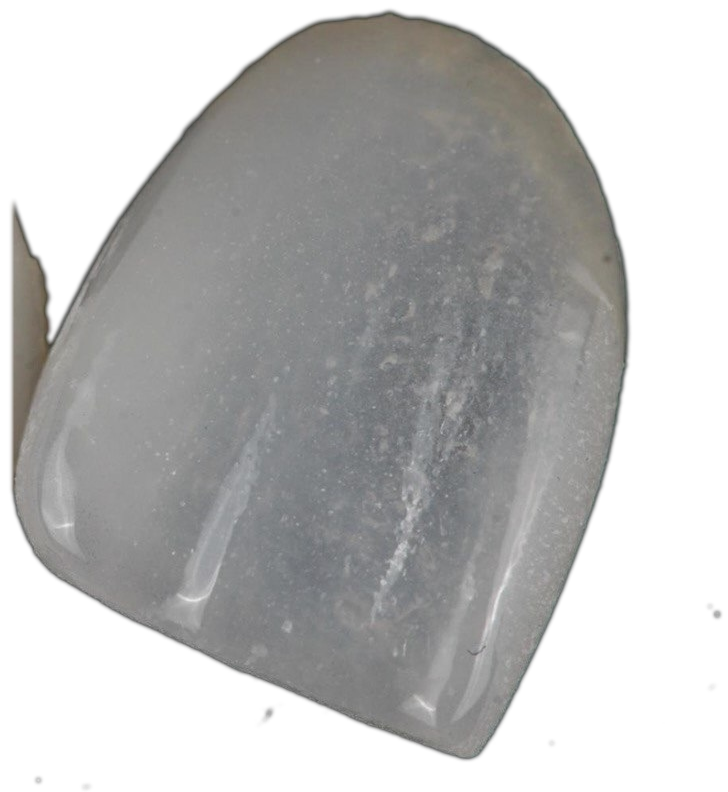Faccetta Belia: ceramica traslucida, il nero si vede attraverso
